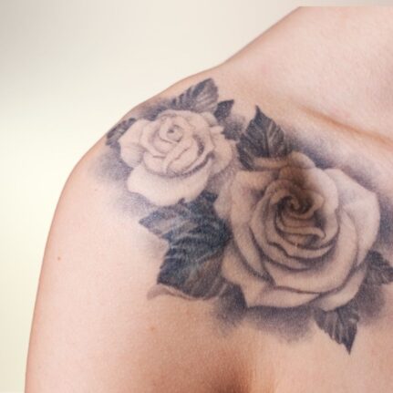 Garai Klaudia - sminktetoválás & tetoválás eltávolítás -LAY Beauty, Vác - Kémiai InSkin és YAG lézeres tetoválás eltávolítás