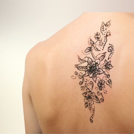 Garai Klaudia - sminktetoválás & tetoválás eltávolítás -LAY Beauty, Vác - Kémiai InSkin és YAG lézeres tetoválás eltávolítás