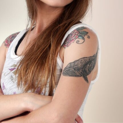 Garai Klaudia - sminktetoválás & tetoválás eltávolítás -LAY Beauty, Vác - Kémiai InSkin és YAG lézeres tetoválás eltávolítás