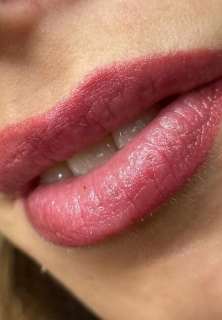 Garai Klaudia - smintetoválás_tetovalas eltavolitas_LAY Beauty Vác - szájtetoválás - referencia